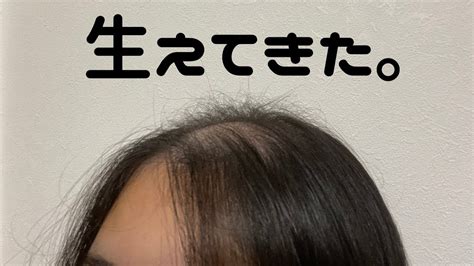 中2女子です。ケツ毛？が生えていて悩んでます。他の人にはな。